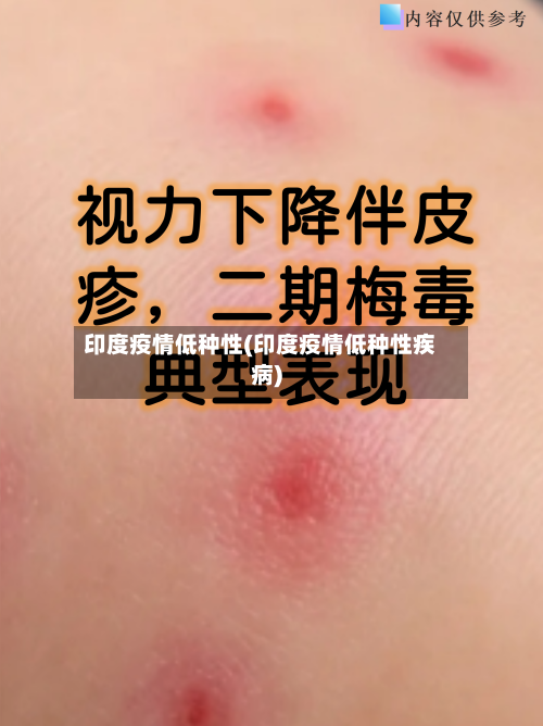 印度疫情低种性(印度疫情低种性疾病)
