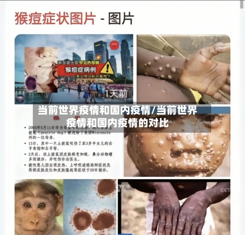 当前世界疫情和国内疫情/当前世界疫情和国内疫情的对比