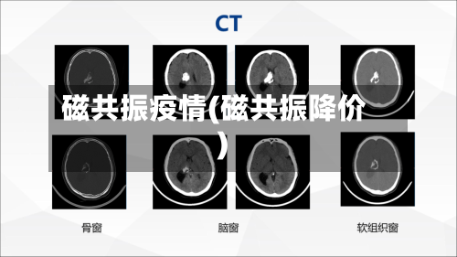 磁共振疫情(磁共振降价)