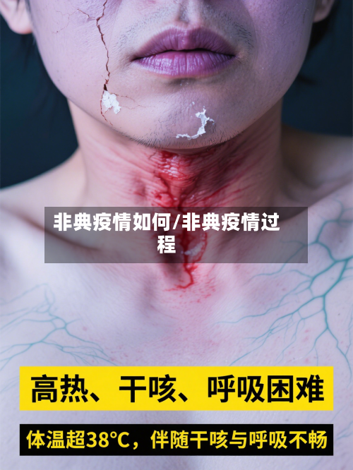 非典疫情如何/非典疫情过程