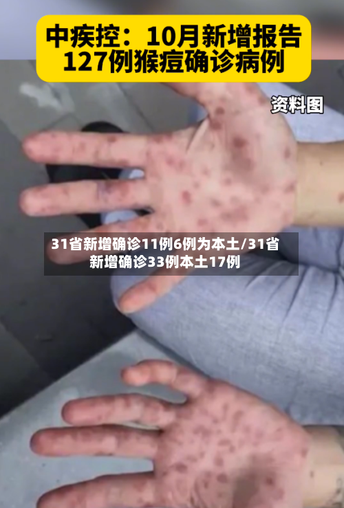 31省新增确诊11例6例为本土/31省新增确诊33例本土17例-第2张图片