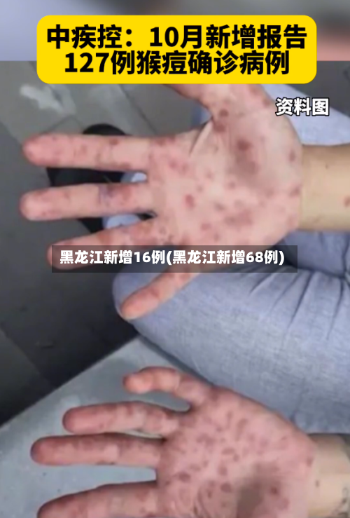 黑龙江新增16例(黑龙江新增68例)-第2张图片